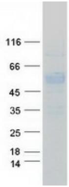 Coomassie blue staining of purified CD27 protein.